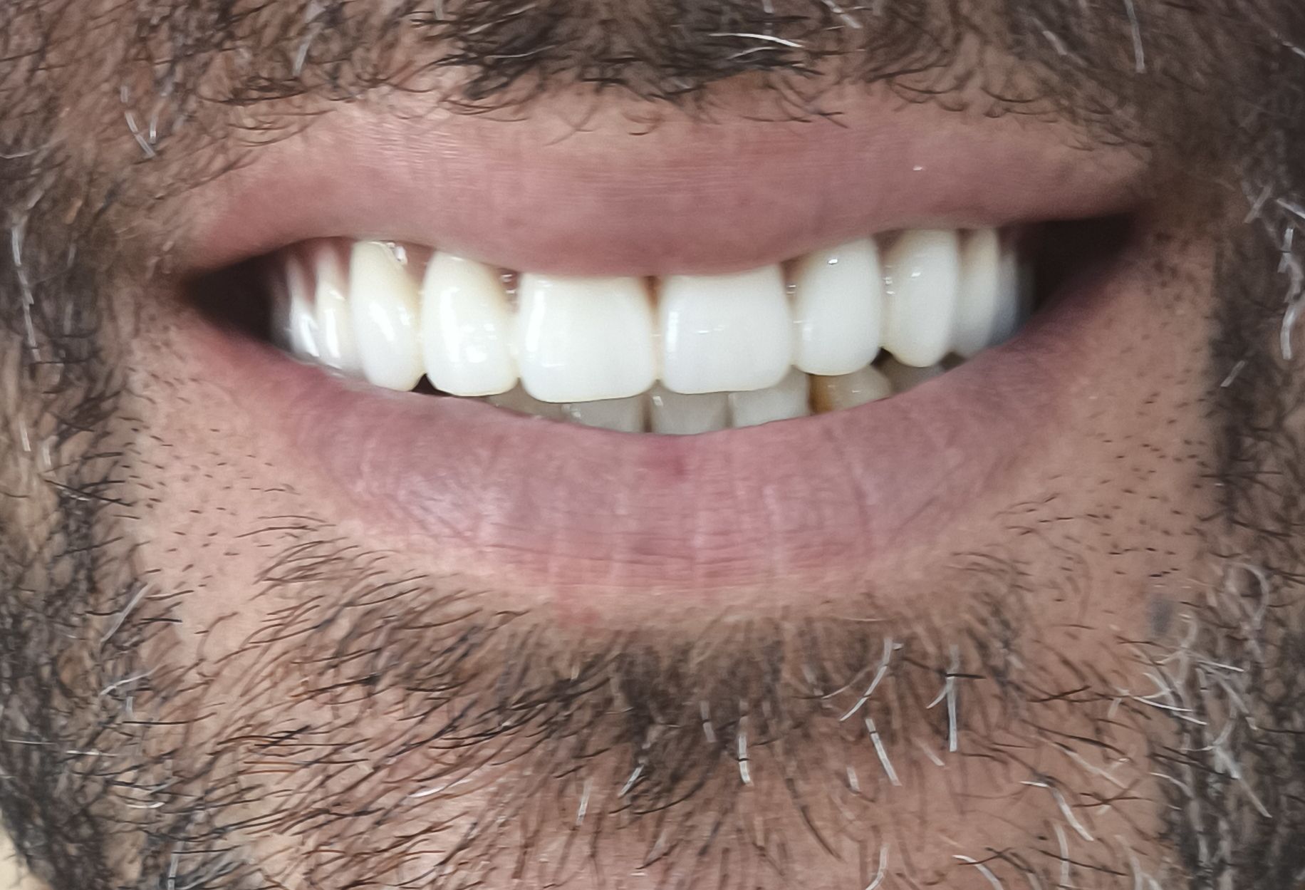 دندانسازی کلینیک دکتر همایون آزاد در شهرکرد