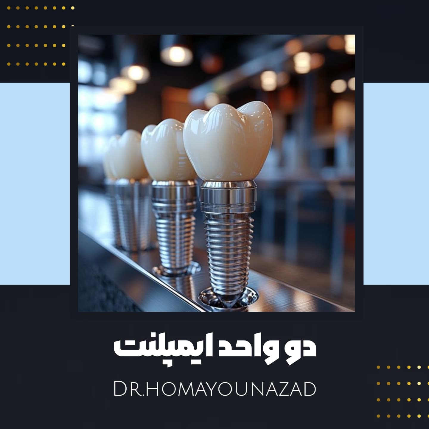 ایمپلنت شهرکرد